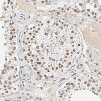 Immunohistochemistry-Paraffin: NCOA6 Antibody [NBP1-89193] - Staining of human testis shows moderate to strong nuclear positivity in cells in seminiferous ducts.