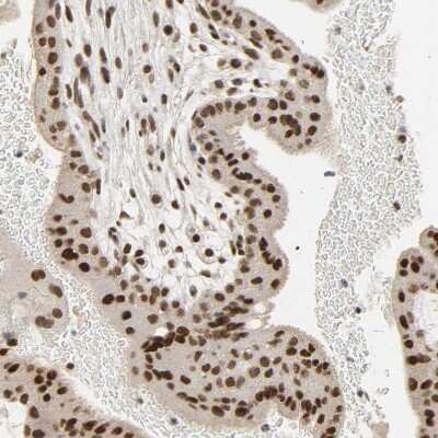 Immunohistochemistry-Paraffin: NCOA6 Antibody [NBP1-89193] - Staining of human placenta shows moderate to strong nuclear positivity in trophoblastic cells.