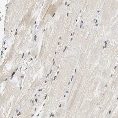 Immunohistochemistry-Paraffin: NCOA6 Antibody [NBP1-89193] - Staining of human skeletal muscle shows weak nuclear positivity in myocytes.