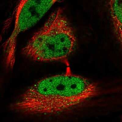 Immunocytochemistry/Immunofluorescence: NCOR1 Antibody [NBP2-48997] - Staining of human cell line HeLa shows localization to nucleoplasm & cytosol.