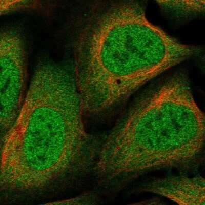 Immunocytochemistry/Immunofluorescence: NCOR1 Antibody [NBP2-58359] - Staining of human cell line U-2 OS shows localization to nucleoplasm & cytosol.