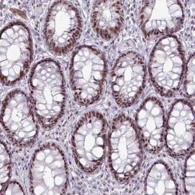 Immunohistochemistry: NCOR1 Antibody [NBP2-47360] - Staining of human rectum shows strong nuclear positivity in glandular cells.