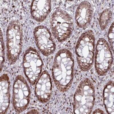 Immunohistochemistry: NCOR1 Antibody [NBP2-48997] - Staining of human rectum shows moderate nuclear positivity in glandular cells.