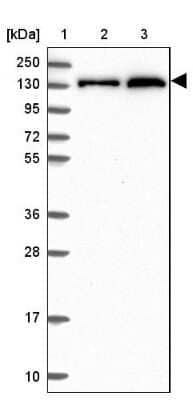 Western Blot: NCOR1 Antibody [NBP2-47360] - Lane 1: Marker  [kDa] 250, 130, 95, 72, 55, 36, 28, 17, 10.  Lane 2: Human cell line RT-4.  Lane 3: Human cell line U-251MG.