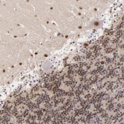 Immunohistochemistry-Paraffin: NCOR2 Antibody [NBP1-85386] - Staining of human cerebellum shows nuclear positivity in purkinje cells, cells in molecular layer and cells in granular layer.