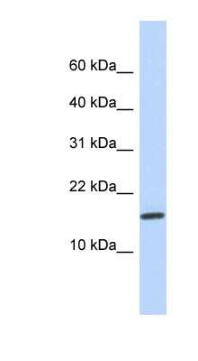 Western Blot: NCRNA00114 Antibody [NBP1-70648] - Titration: 0.2-1 ug/ml, Positive Control: Human heart.