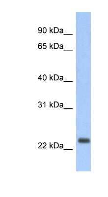 Western Blot: ND6 Antibody [NBP1-70650] - Human Lung lysate, concentration 0.2-1 ug/ml.