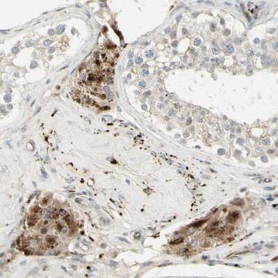 Immunohistochemistry-Paraffin NDFIP1 Antibody - BSA Free