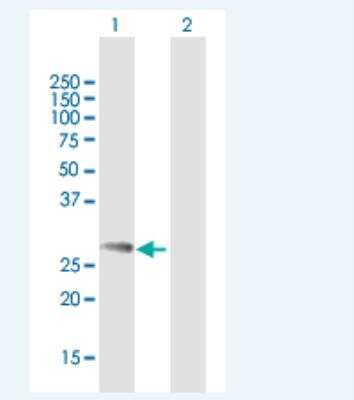 Western Blot: NDFIP1 Antibody [H00080762-B01P-50ug] - Analysis of NDFIP1 expression in transfected 293T cell line by NDFIP1 MaxPab polyclonal antibody.  Lane 1: NDFIP1 transfected lysate(24.31 KDa). Lane 2: Non-transfected lysate.