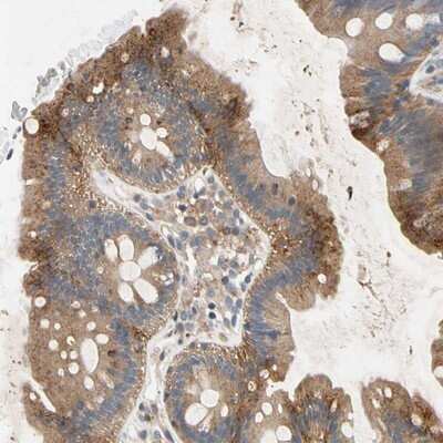 Immunohistochemistry-Paraffin NDFIP2 Antibody