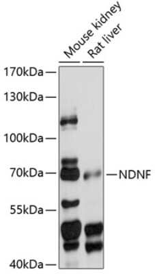Western Blot: NDNF Antibody [NBP2-94089] - Analysis of extracts of various cell lines, using NDNF at 1:1000 dilution.Secondary antibody: HRP Goat Anti-Rabbit IgG (H+L) at 1:10000 dilution.Lysates/proteins: 25ug per lane.Blocking buffer: 3% nonfat dry milk in TBST.Detection: ECL Basic Kit .Exposure time: 30s.