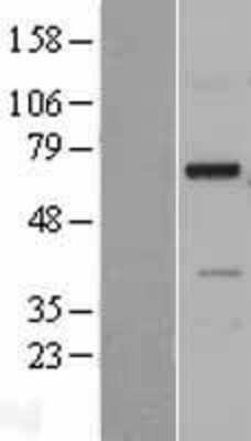 Western Blot NDNF Overexpression Lysate
