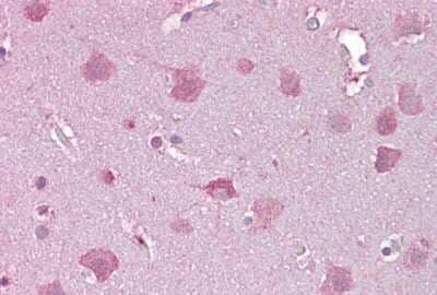 Immunohistochemistry-Paraffin: NDP/Norrin Antibody [NBP1-59305] - Human Brain, cortex tissue at an antibody concentration of 5ug/ml.