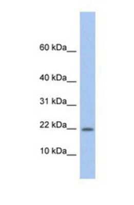 Western Blot: NDP/Norrin Antibody [NBP1-59305] - Fetal Liver tissue lysate at a concentration of 1ug/ml.