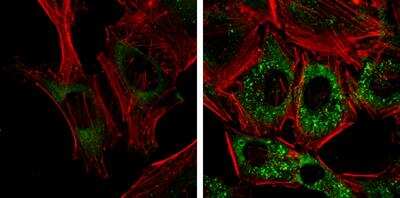 <b>Biological Strategies Validation and Genetic Strategies Validation.</b>Immunocytochemistry/Immunofluorescence: NDP52 Antibody (1813) [NBP2-43588] - Analysis of Samples: HeLa cells mock (left) and treated with 50uM Chloroquine for 24 hr (right) were fixed in 4% paraformaldehyde at RT for 15 min. Green: NDP52 protein stained by NDP52 antibody [1813]. Red: Phalloidin, a F-actin marker.