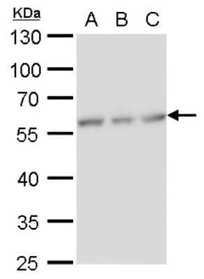 Western Blot: NDP52 Antibody (1813) [NBP2-43588] - Analysis of A. 30 ug Huh7 whole cell lysate/extract B. 30 ug Hep3B whole cell lysate/extract C. 30 ug HepG2 whole cell lysate/extract 10 % SDS-PAGE NDP52 antibody [1813] dilution: 1:1000