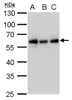 Western Blot: NDP52 Antibody (1813) [NBP2-43588] - Analysis of A. 30 ug Jurkat whole cell lysate/extract B. 30 ug Raji whole cell lysate/extract C. 30 ug NCI-H929 whole cell lysate/extract 10 % SDS-PAGE NDP52 antibody [1813] dilution: 1:1000.