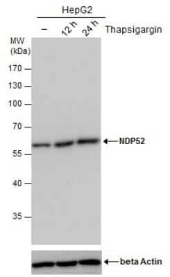 <b>Biological Strategies Validation. </b>Western Blot: NDP52 Antibody (1813) [NBP2-43588] - Analysis of un-treated (-) and treated (+), Thapsigargin treatment for 12hrs and 24hrs. HepG2 whole cell extracts (30 ug) were separated by 10% SDS-PAGE, and the membrane was blotted with NDP52 antibody. The ACTB was used as an  internal control (bottom panel).