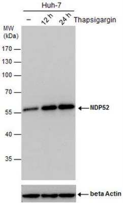 <b>Biological Strategies Validation. </b>Western Blot: NDP52 Antibody (1813) [NBP2-43588] - Analysis of un-treated (-) and treated (+), Thapsigargin treatment for 12hrs and 24hrs. Huh-7 whole cell extracts (30 ug) were separated by 10% SDS-PAGE, and the membrane was blotted with NDP52 antibody. ACTB was used as internal control (bottom panel).