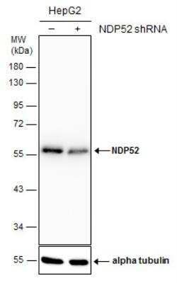 Western Blot: NDP52 Antibody (1813) [NBP2-43588] - Non-transfected (-) and transfected (+) HepG2 whole cell extracts (30 ug) were separated by 10% SDS-PAGE, and the membrane was blotted with NDP52 antibody [GT1813].