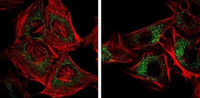 <b>Biological Strategies Validation. </b>Immunocytochemistry/Immunofluorescence: NDP52 Antibody (422) [NBP2-43696] - Analysis of Samples: HeLa cells mock (left) and treated with 50uM Chloroquine for 24 hr (right) were fixed in 4% paraformaldehyde at RT for 15 min. Green: NDP52 protein stained by NDP52 antibody [422]. Red: Phalloidin, a F-actin marker.