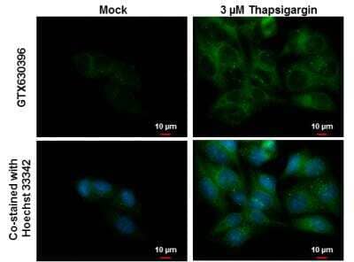 <b>Biological Strategies Validation. </b>Immunocytochemistry/Immunofluorescence: NDP52 Antibody (422) [NBP2-43696] - Analysis of Samples: HepG2 cells mock (left) and treated with 3 uM Thapsigargin for 16 hrs (right) were fixed in ice-cold MeOH for 10 min and permeabilized with 100% MeOH for 30 sec. Green: NDP52 protein stained by NDP52 antibody [422]. Blue: Hoechst 33342 staining. Scale bar = 10 um.