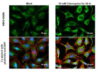 <b>Genetic Strategies Validation. </b>Immunocytochemistry/Immunofluorescence: NDP52 Antibody (422) [NBP2-43696] - NDP52 antibody (422) detects NDP52 protein at autophagosome by immunofluorescent analysis. Sample: Mock and treated HeLa cells were fixed in 4% paraformaldehyde at RT for 15 min. Green: NDP52 stained by NDP52 antibody (422) diluted at 1:1000. Red: phalloidin, a cytoskeleton marker, diluted at 1:200. Blue: Fluoroshield with DAPI. Scale bar= 10 um.