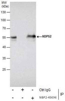 Immunoprecipitation: NDP52 Antibody (422) [NBP2-43696] - Immunoprecipitation of NDP52 protein from Jurkat whole cell extracts using 5 ug of NDP52 antibody [422]. Western blot analysis was performed using NDP52 antibody [422]. EasyBlot anti-Mouse IgG was used as a secondary reagent.