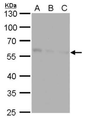 Western Blot: NDP52 Antibody (422) [NBP2-43696] - Analysis of A. 30 ug Huh7 whole cell lysate/extract B. 30 ug Hep3B whole cell lysate/extract C. 30 ug HepG2 whole cell lysate/extract 10 % SDS-PAGE NDP52 antibody [422] dilution: 1:1000