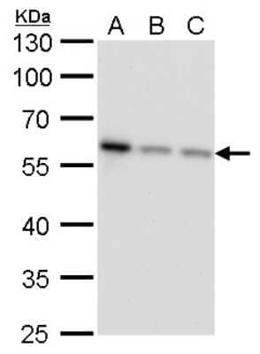 Western Blot: NDP52 Antibody (422) [NBP2-43696] - Analysis of A. 30 ug Jurkat whole cell lysate/extract B. 30 ug Raji whole cell lysate/extract C. 30 ug NCI-H929 whole cell lysate/extract 10 % SDS-PAGE NDP52 antibody [422] dilution: 1:1000.