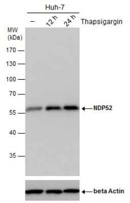 <b>Biological Strategies Validation. </b>Western Blot: NDP52 Antibody (422) [NBP2-43696] - Analysis of un-treated (-) and treated (+), Thapsigargin treatment for 12hrs and 24hrs. Huh-7 whole cell extracts (30 ug) were separated by 10% SDS-PAGE, and the membrane was blotted with NDP52 antibody. ACTB was used as internal control (bottom panel).