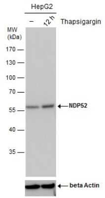 <b>Biological Strategies Validation. </b>Western Blot: NDP52 Antibody (422) [NBP2-43696] - Analysis of un-treated (-) and treated (+), Thapsigargin treatment for 12hrs. HepG2 whole cell extracts (30 ug) were separated by 10% SDS-PAGE, and the membrane was blotted with NDP52 antibody. ACTB was used as internal control (bottom panel).