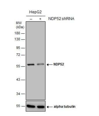 Western Blot: NDP52 Antibody (422) [NBP2-43696] - Non-transfected (-) and transfected (+) HepG2 whole cell extracts (30 ug) were separated by 10% SDS-PAGE, and the membrane was blotted with NDP52 antibody [422].