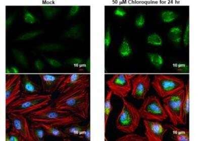 <b>Biological Strategies Validation. </b>Immunocytochemistry/Immunofluorescence: NDP52 Antibody [NBP2-19499] - NDP52 antibody detects NDP52 protein at autophagosome  by immunofluorescent analysis. Sample: Mock and treated HeLa cells were fixed in 4% paraformaldehyde at RT for 15 min. Green: NDP52 stained by NDP52 antibody diluted at 1:1000.Red: phalloidin, a cytoskeleton marker, diluted at 1:200. Blue: Fluoroshield with DAPI.Scale bar= 10 um.