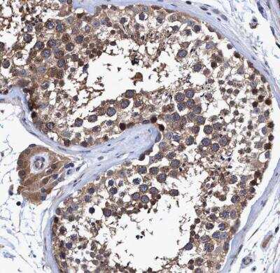 Immunohistochemistry-Paraffin: NDP52 Antibody [NBP1-87872] - Staining of human testis shows strong cytoplasmic positivity in cells in seminiferous ducts.