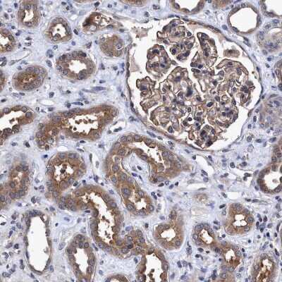 Immunohistochemistry-Paraffin: NDP52 Antibody [NBP1-87872] - Staining of human kidney shows moderate cytoplasmic positivity in cells in tubules.