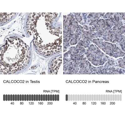 Immunohistochemistry-Paraffin: NDP52 Antibody [NBP1-87873] - Analysis in human testis and pancreas tissues. Corresponding NDP52 RNA-seq data are presented for the same tissues.