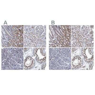 <b>Independent Antibodies Validation and Orthogonal Strategies Validation.</b>Immunohistochemistry-Paraffin: NDP52 Antibody [NBP1-87873] - Staining of human gastrointestinal, kidney, pancreas and testis using Anti-NDP52 antibody NBP1-87873 (A) shows similar protein distribution across tissues to independent antibody NBP1-87874 (B).