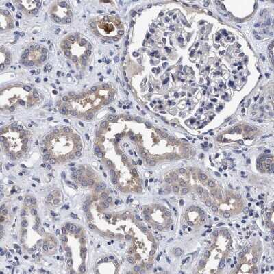 Immunohistochemistry-Paraffin: NDP52 Antibody [NBP1-87873] - Staining of human kidney shows weak cytoplasmic positivity in cells in tubules.