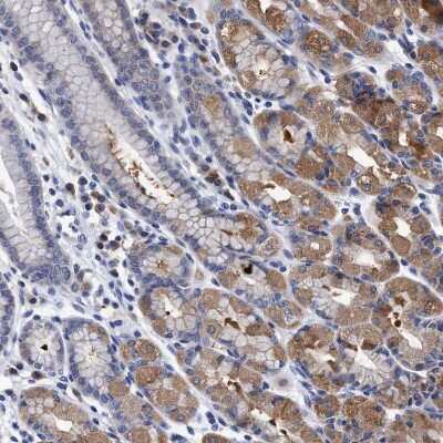 Immunohistochemistry-Paraffin: NDP52 Antibody [NBP1-87873] - Staining of human stomach shows moderate cytoplasmic positivity in glandular cells.