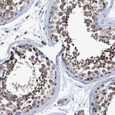 Immunohistochemistry-Paraffin: NDP52 Antibody [NBP1-87873] - Staining of human testis shows  strong cytoplasmic positivity in cells in seminiferous ducts.