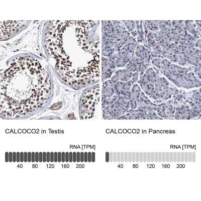 <b>Orthogonal Strategies Validation. </b>Immunohistochemistry-Paraffin: NDP52 Antibody [NBP1-87874] - Analysis in human testis and pancreas tissues. Corresponding NDP52 RNA-seq data are presented for the same tissues.