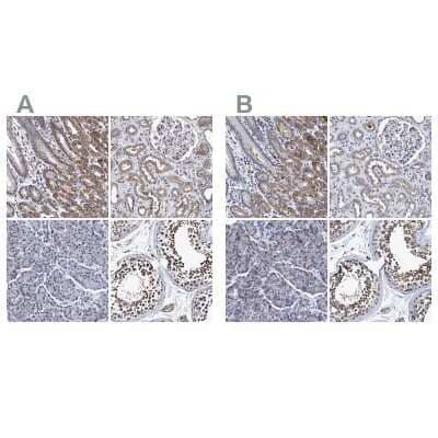 <b>Independent Antibodies Validation. </b>Immunohistochemistry-Paraffin: NDP52 Antibody [NBP1-87874] - Staining of human gastrointestinal, kidney, pancreas and testis using Anti-NDP52 antibody NBP1-87874 (A) shows similar protein distribution across tissues to independent antibody NBP1-87873 (B).