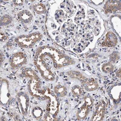 Immunohistochemistry-Paraffin: NDP52 Antibody [NBP1-87874] - Staining of human kidney shows  moderate cytoplasmic positivity in cells in tubules.