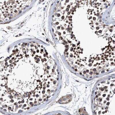 Immunohistochemistry-Paraffin: NDP52 Antibody [NBP1-87874] - Staining of human testis shows strong cytoplasmic positivity in cells in seminiferous ducts.