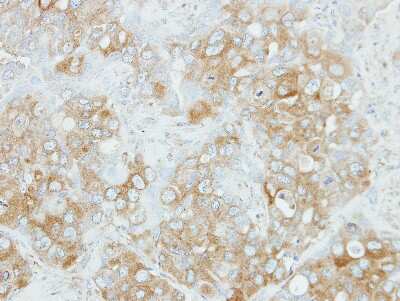 Immunohistochemistry-Paraffin: NDP52 Antibody [NBP2-19499] -  H441 xenograft, using NDP52 antibody at 1:100 dilution. Antigen Retrieval: Trilogy™ (EDTA based, pH 8.0) buffer, 15min. 