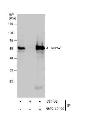 Immunoprecipitation: NDP52 Antibody [NBP2-19499] -  Jurkat whole cell extracts using 5 ug of NDP52 antibody.  Western blot analysis was performed using NDP52 antibody.  EasyBlot anti-Rabbit IgG was used as a secondary reagent.