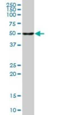 Western Blot: NDP52 Antibody [H00010241-B01P] - Analysis of CALCOCO2 expression in human liver.