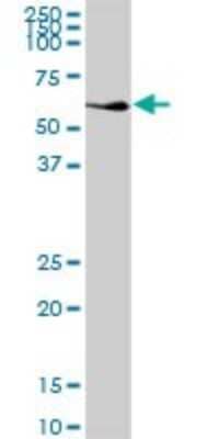 Western Blot: NDP52 Antibody [H00010241-B01P] - Analysis of CALCOCO2 expression in human pancreas.