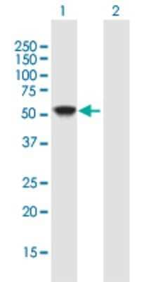 Western Blot: NDP52 Antibody [H00010241-B01P] - Analysis of CALCOCO2 expression in transfected 293T cell line by CALCOCO2 polyclonal antibody.  Lane 1: CALCOCO2 transfected lysate(49.06 KDa). Lane 2: Non-transfected lysate.